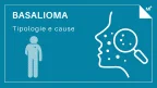 Cos'è il basalioma? - Infografica