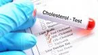 Gli esami del sangue per il colesterolo
