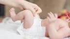 Ernia ombelicale neonato.