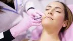 Filler acido ialuronico.