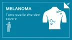 Cos'è il melanoma? - Infografica