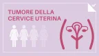 Tumore del collo dell'utero (o cervice uterina) - Infografica