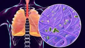 Pertosse: batterio bordetella pertussis