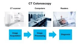 Colonscopia virtuale