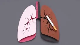 fumo Differenza tra polmone sano e carcinoma polmonare da fumo