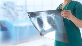 Radiografia torace per la diagnosi polmonite