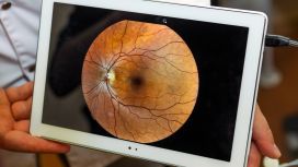 Esame della retina o fundus oculi