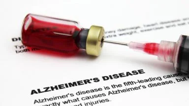 alzheimer diagnosi sangue.webp