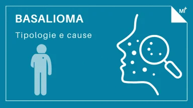 Basalioma infografica.