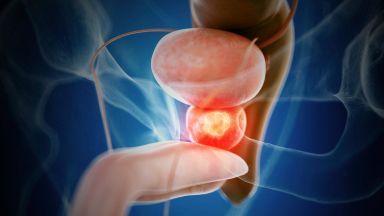 Cancro prostata terapia testosterone