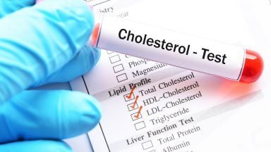 Colesterolo esami del sangue