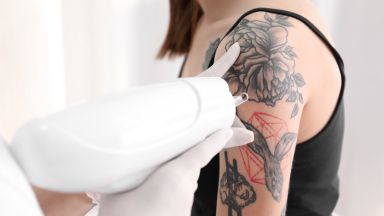melanoma
