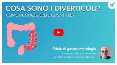 Diverticoli: cosa sono, come riconoscerli e quando preoccuparsi