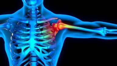 Le 10 cause più frequenti di dolore alla spalla