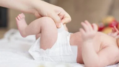 Ernia ombelicale neonato.