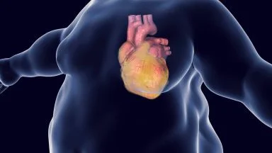 Grasso viscerale, il più pericoloso di tutti: dove si deposita, quali rischi comporta e come ridurlo