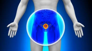 Quando la prostata aumenta di volume: l’ipertrofia prostatica benigna