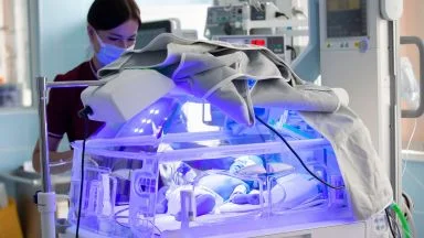 Neonato sottoposto a fototerapia per la cura dell'ittero neonatale.