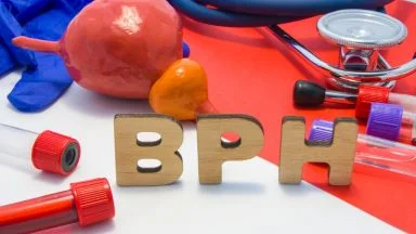 Optilume BPH: nuovo dispositivo per il trattamento mini-invasivo dell'ipertrofia prostatica benigna