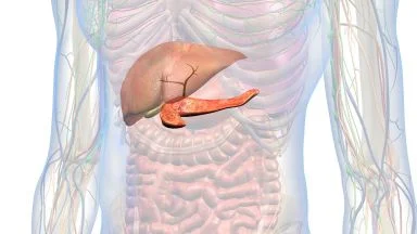 Pancreatite