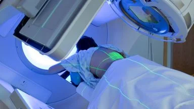Radioterapia: a cosa serve? Quale tipo? Quali effetti collaterali?