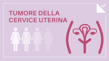 Tumore cervice uterina infografica.