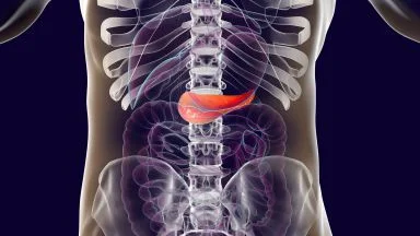 Le neoplasie del pancreas: fattori di rischio, diagnosi e trattamento