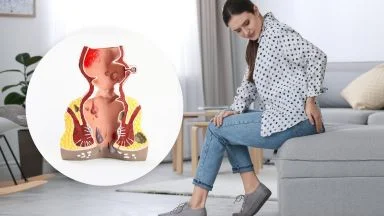 Ulcera solitaria del retto.