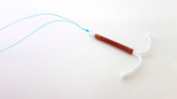 Spirale anticoncezionale IUD e IUS: tipologie e differenze