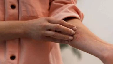 Quali sono i tessuti che causano meno allergie sulla pelle: con questi non soffrirai più di prurito