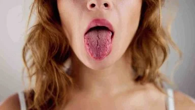 Se la tua lingua ha questo colore la tua salute è in grave pericolo (ma te ne accorgi tardi)