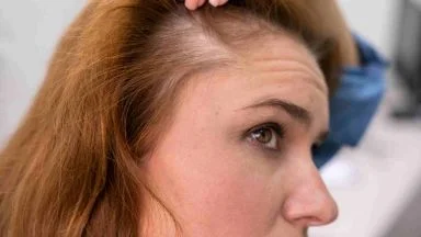 Lo facciamo tutti ogni giorno, ma ci farà perdere i capelli: smetti finché sei in tempo