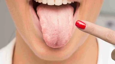 Sapore metallico in bocca: 4 cause insospettabili (che dovrebbero preoccuparti)