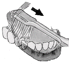 Pulizia dei denti posteriori