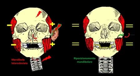 Posizione del cranio prima e dopo la terapia