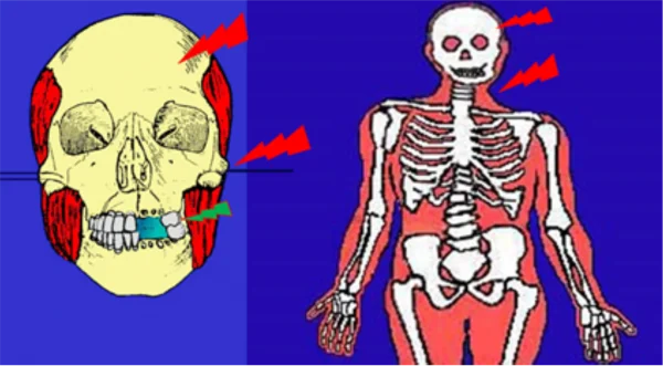 Malposizione mandibolare e postura compensatoria