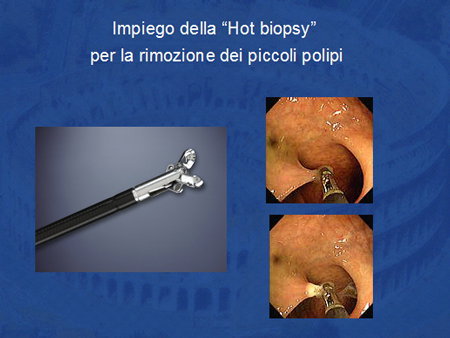 Hot biopsy