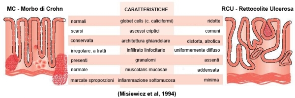 Istologia delle IBD