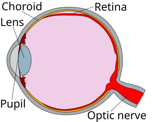 Distacco della retina